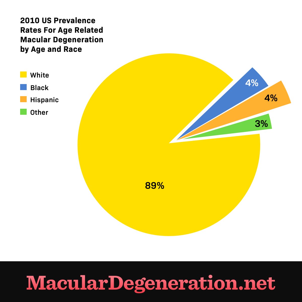 89 percent of those diagnosed with age-related macular degeneration are white