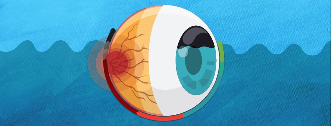 An eyeball floating in a body of water and liquid is rising inside it.