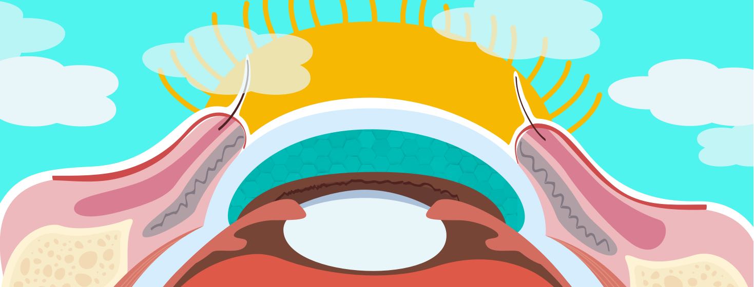 A side profile of the interior of an eye. The sun is rising behind it and there are clouds rolling in.