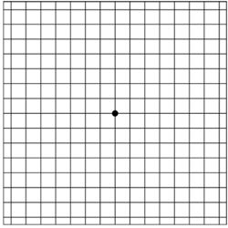 Amsler Grid Chart & Example