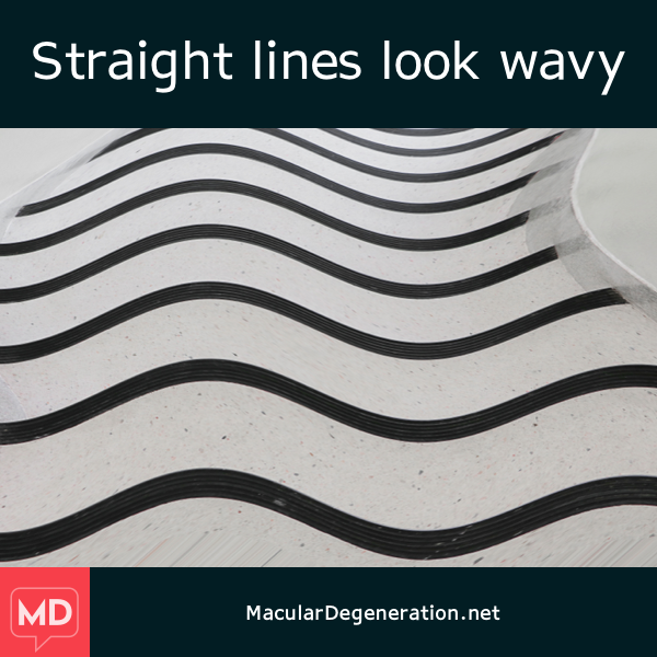 wavy-lines-in-vision-zig-zag-causes-and-treatments-healthhype