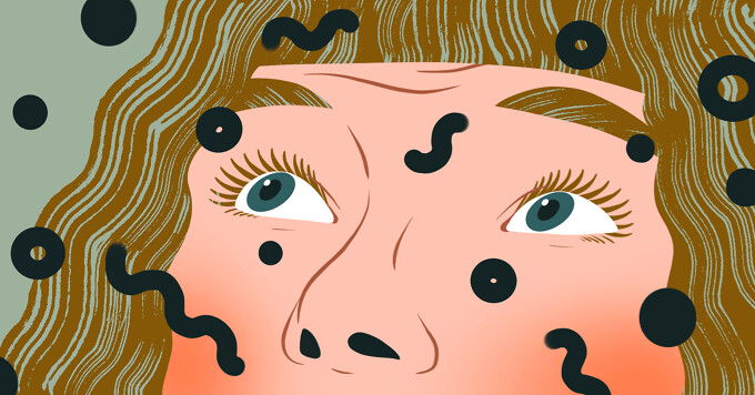 Managing Post-Injection Eye Floaters image